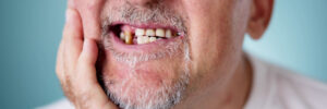 Man with cracked tooth in pain