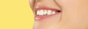 Close up of a beautiful woman's smile with health gums